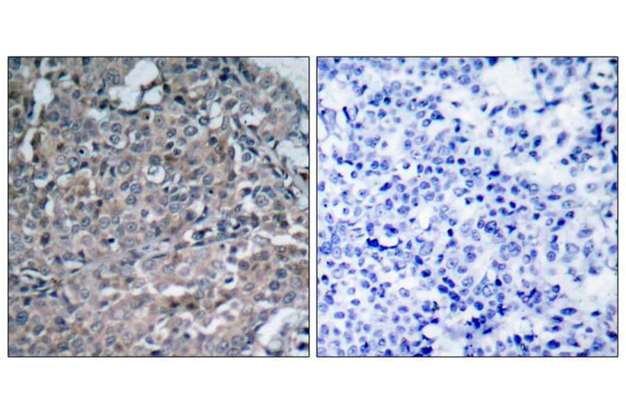Immunohistochemistry - FAK (Ab-925) Antibody from Signalway Antibody (21148) - Antibodies.com