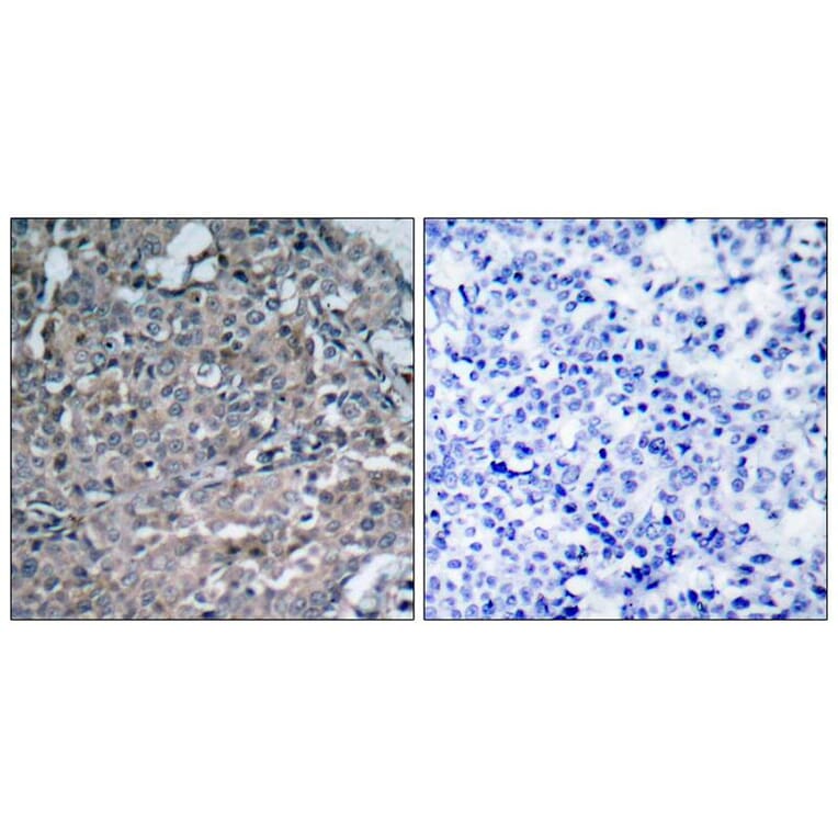 Immunohistochemistry - FAK (Ab-925) Antibody from Signalway Antibody (21148) - Antibodies.com