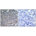 Immunohistochemistry - FAK (Ab-925) Antibody from Signalway Antibody (21148) - Antibodies.com