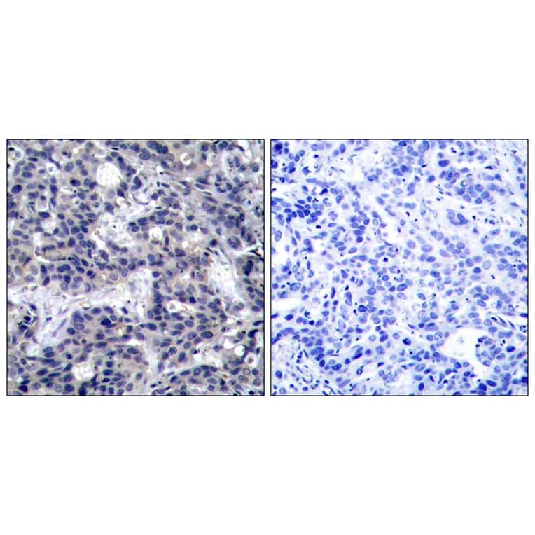 Immunohistochemistry - PKR (Ab-446) Antibody from Signalway Antibody (21272) - Antibodies.com