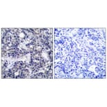 Immunohistochemistry - PKR (Ab-446) Antibody from Signalway Antibody (21272) - Antibodies.com