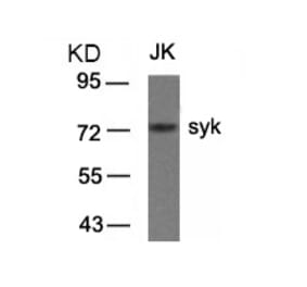 Western blot - syk (Ab-323) Antibody from Signalway Antibody (21546) - Antibodies.com