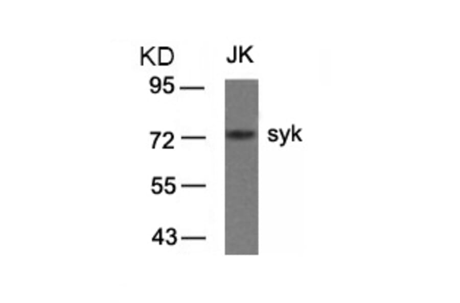 Western blot - syk (Ab-323) Antibody from Signalway Antibody (21546) - Antibodies.com