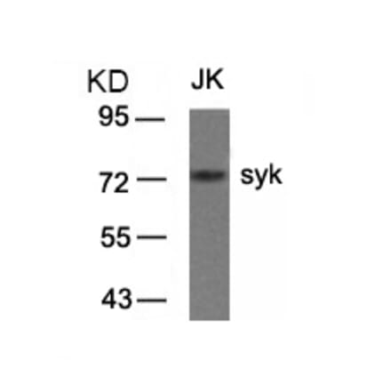 Western blot - syk (Ab-323) Antibody from Signalway Antibody (21546) - Antibodies.com