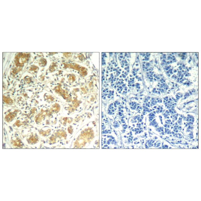 Immunohistochemistry - syk (Ab-323) Antibody from Signalway Antibody (21546) - Antibodies.com