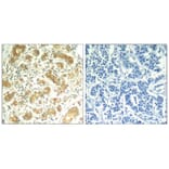 Immunohistochemistry - syk (Ab-323) Antibody from Signalway Antibody (21546) - Antibodies.com