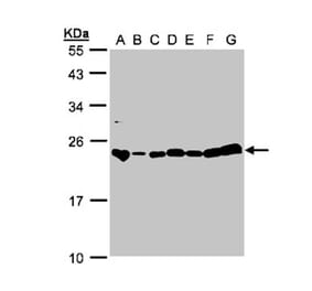 glyoxalase I antibody from Signalway Antibody (22161) - Antibodies.com