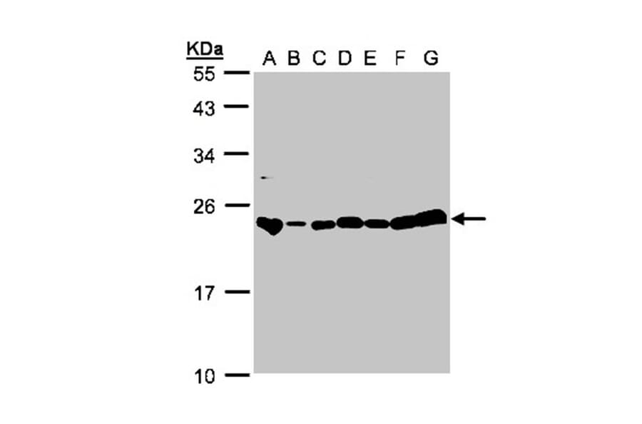 glyoxalase I antibody from Signalway Antibody (22161) - Antibodies.com