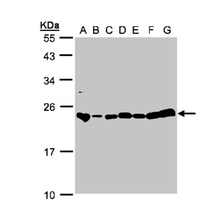 glyoxalase I antibody from Signalway Antibody (22161) - Antibodies.com