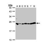 glyoxalase I antibody from Signalway Antibody (22161) - Antibodies.com