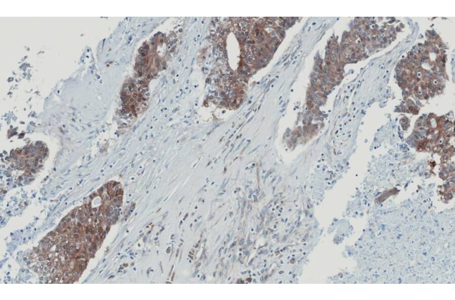 Immunohistochemistry - glyoxalase I antibody from Signalway Antibody (22161) - Antibodies.com