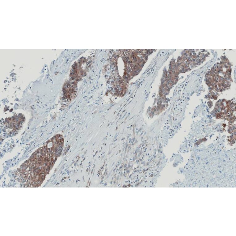 Immunohistochemistry - glyoxalase I antibody from Signalway Antibody (22161) - Antibodies.com