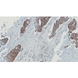 Immunohistochemistry - glyoxalase I antibody from Signalway Antibody (22161) - Antibodies.com