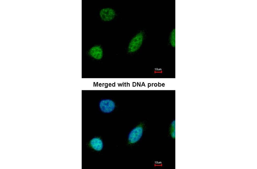 Immunofluorescence - glyoxalase I antibody from Signalway Antibody (22161) - Antibodies.com