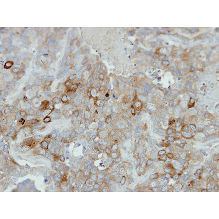 Immunohistochemistry - Calmodulin 2 antibody from Signalway Antibody (22363) - Antibodies.com