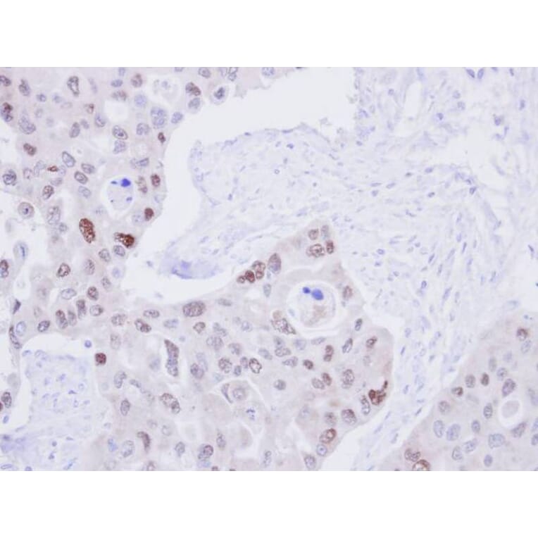 Immunohistochemistry - DNA ligase 3 antibody from Signalway Antibody (22508) - Antibodies.com