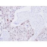 Immunohistochemistry - DNA ligase 3 antibody from Signalway Antibody (22508) - Antibodies.com