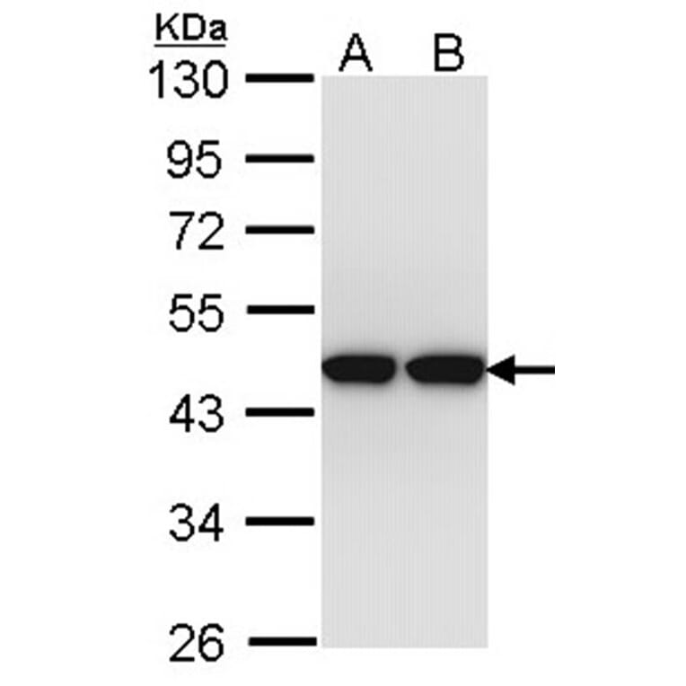 actin-like 8 antibody from Signalway Antibody (22524) - Antibodies.com
