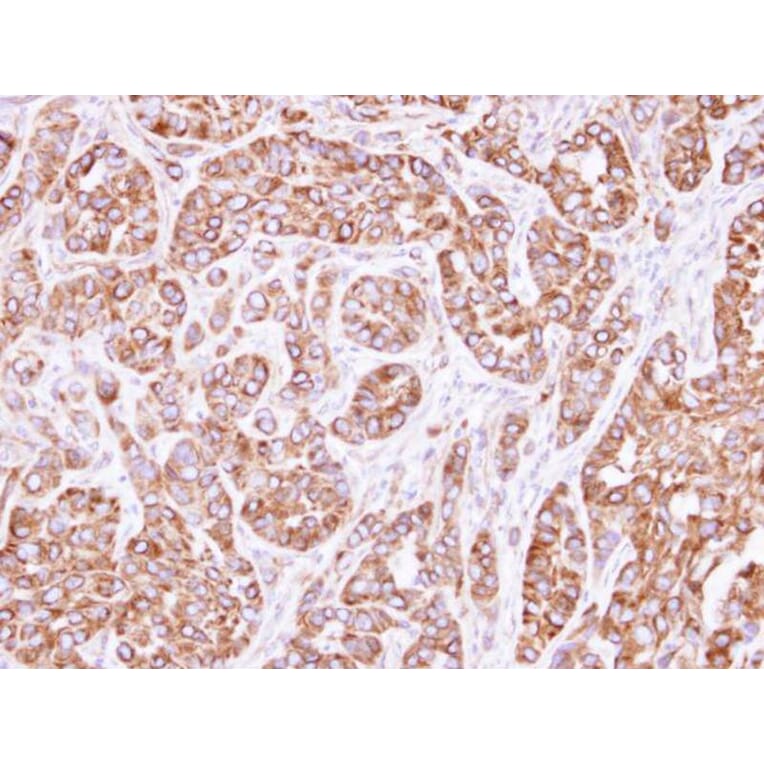 Immunohistochemistry - actin-like 8 antibody from Signalway Antibody (22524) - Antibodies.com