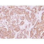 Immunohistochemistry - actin-like 8 antibody from Signalway Antibody (22524) - Antibodies.com