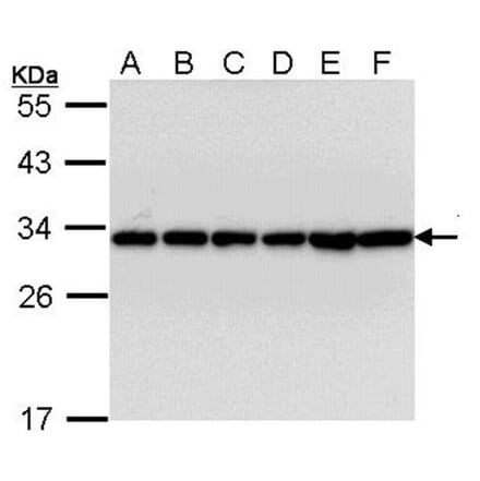 14-3-3 beta antibody from Signalway Antibody (22832) - Antibodies.com