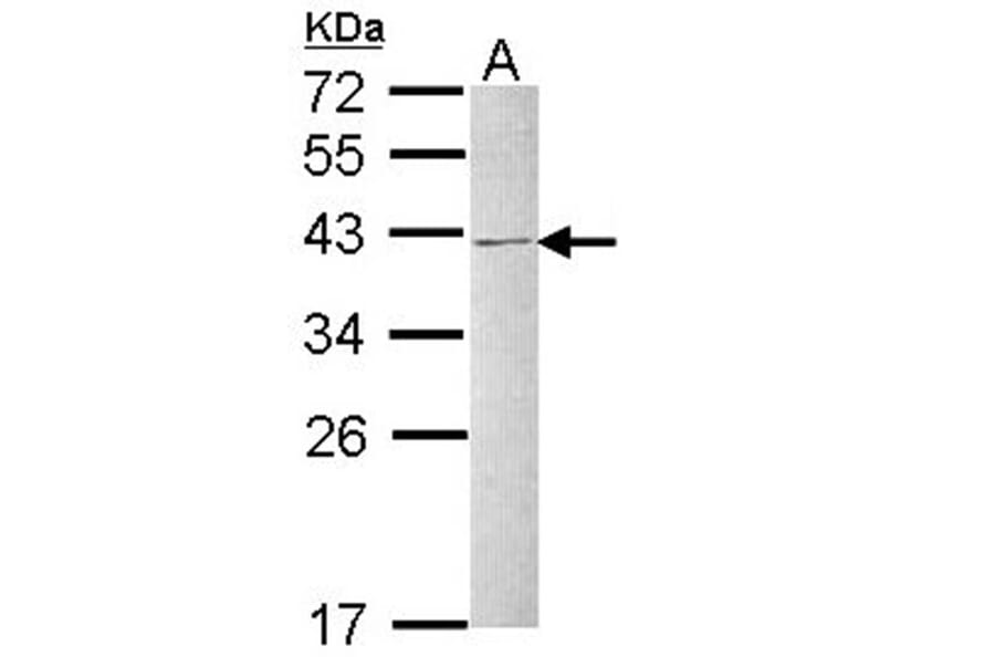 hnRNP C1/C2 antibody from Signalway Antibody (22836) - Antibodies.com