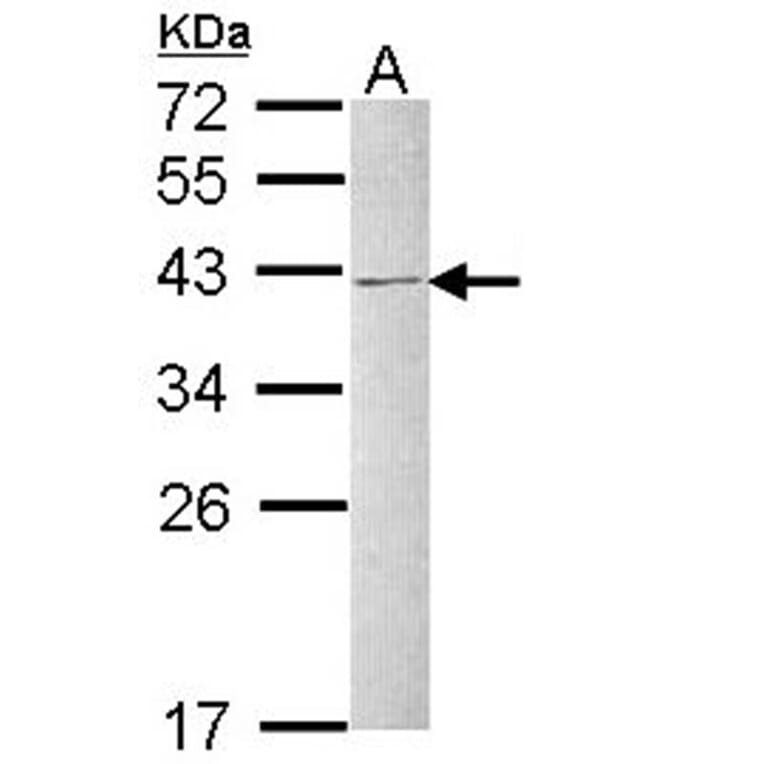 hnRNP C1/C2 antibody from Signalway Antibody (22836) - Antibodies.com