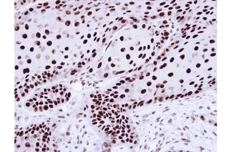 Immunohistochemistry - hnRNP C1/C2 antibody from Signalway Antibody (22836) - Antibodies.com