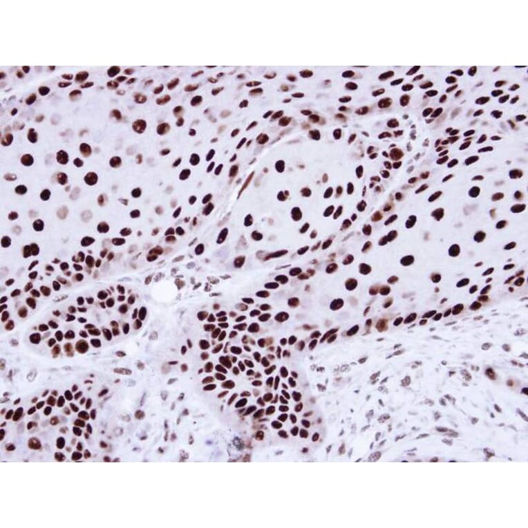 Immunohistochemistry - hnRNP C1/C2 antibody from Signalway Antibody (22836) - Antibodies.com
