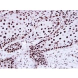 Immunohistochemistry - hnRNP C1/C2 antibody from Signalway Antibody (22836) - Antibodies.com
