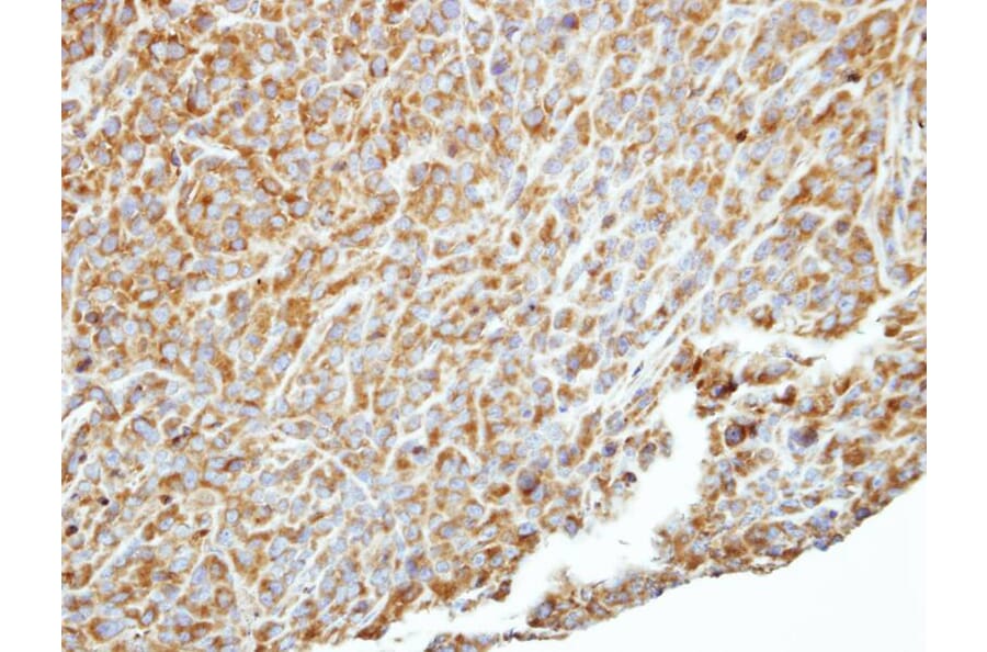 Immunohistochemistry - p150 (PIK3R4) antibody from Signalway Antibody (22851) - Antibodies.com