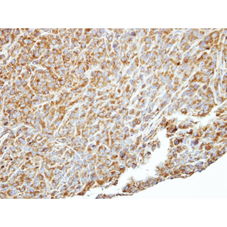 Immunohistochemistry - p150 (PIK3R4) antibody from Signalway Antibody (22851) - Antibodies.com