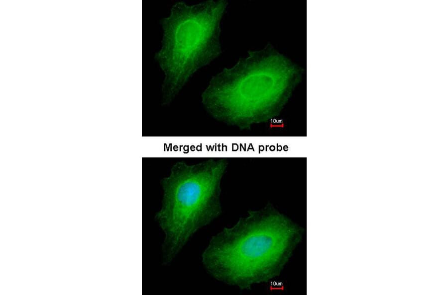 Immunofluorescence - p150 (PIK3R4) antibody from Signalway Antibody (22851) - Antibodies.com