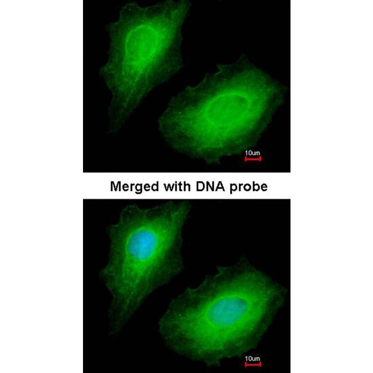 Immunofluorescence - p150 (PIK3R4) antibody from Signalway Antibody (22851) - Antibodies.com