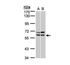 AMPK alpha 2 antibody from Signalway Antibody (22873) - Antibodies.com
