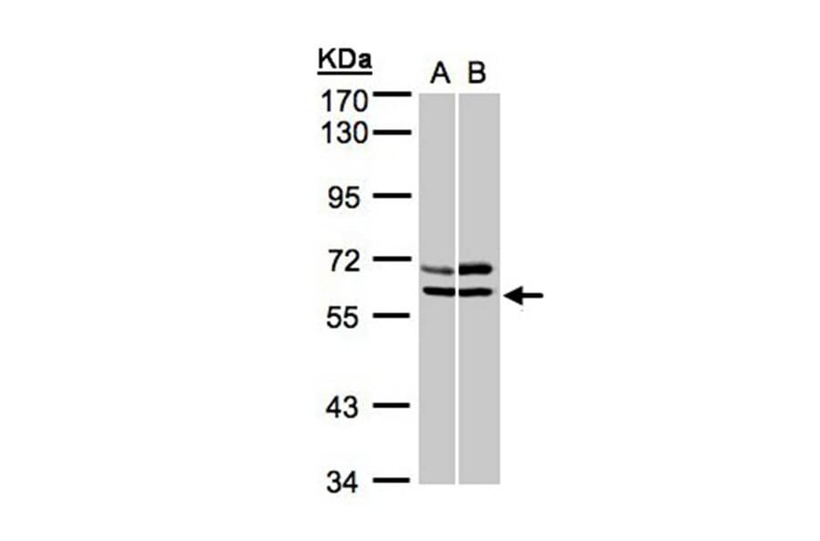 AMPK alpha 2 antibody from Signalway Antibody (22873) - Antibodies.com