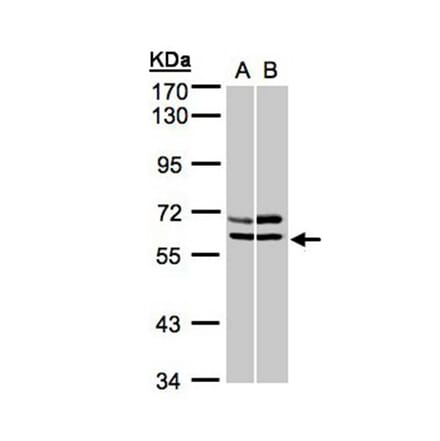 AMPK alpha 2 antibody from Signalway Antibody (22873) - Antibodies.com