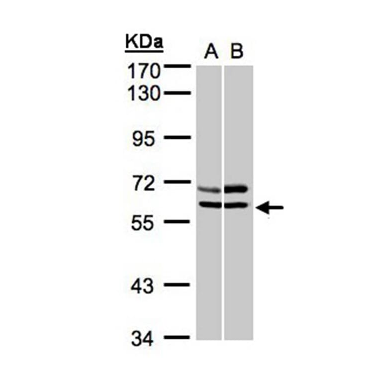 AMPK alpha 2 antibody from Signalway Antibody (22873) - Antibodies.com