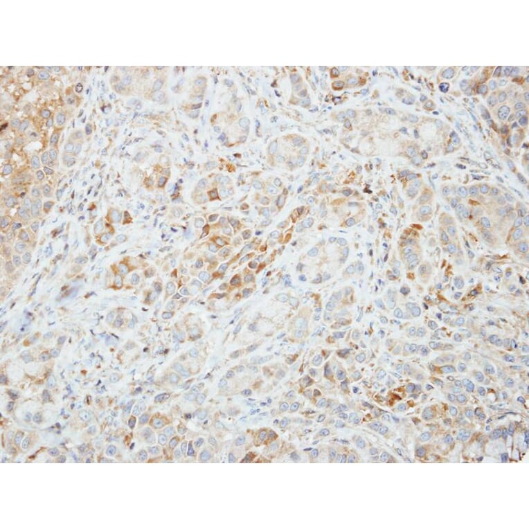 Immunohistochemistry - AMPK alpha 2 antibody from Signalway Antibody (22873) - Antibodies.com