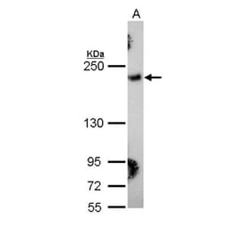 Collagen III antibody from Signalway Antibody (22894) - Antibodies.com