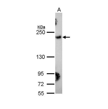 Collagen III antibody from Signalway Antibody (22894) - Antibodies.com