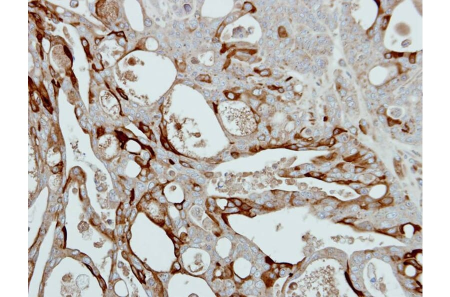 Immunohistochemistry - Collagen III antibody from Signalway Antibody (22894) - Antibodies.com