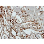 Immunohistochemistry - Collagen III antibody from Signalway Antibody (22894) - Antibodies.com