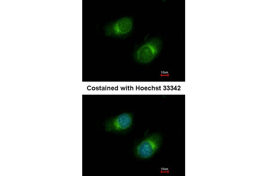 Immunofluorescence - Collagen III antibody from Signalway Antibody (22894) - Antibodies.com