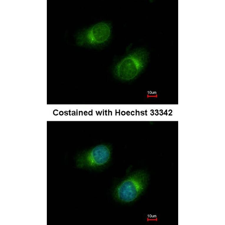 Immunofluorescence - Collagen III antibody from Signalway Antibody (22894) - Antibodies.com