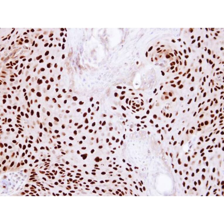 Immunohistochemistry - Ku80 (XRCC5) antibody from Signalway Antibody (22944) - Antibodies.com