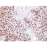 Immunohistochemistry - Ku80 (XRCC5) antibody from Signalway Antibody (22944) - Antibodies.com