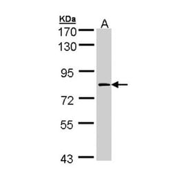 Factor XIIIa antibody from Signalway Antibody (22995) - Antibodies.com