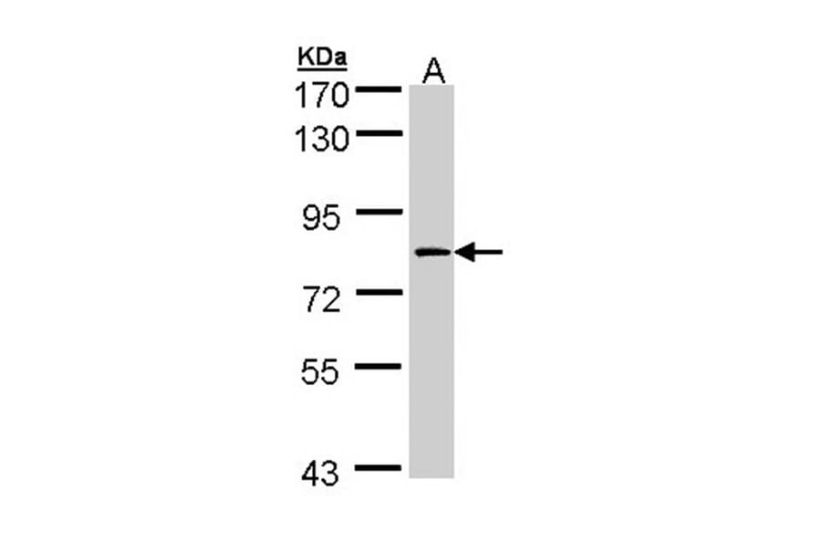 Factor XIIIa antibody from Signalway Antibody (22995) - Antibodies.com