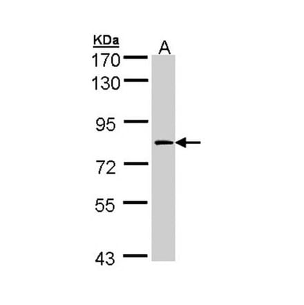 Factor XIIIa antibody from Signalway Antibody (22995) - Antibodies.com